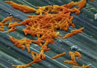 /album/expertise-consultoria-em-saude/clostridium-jpg/